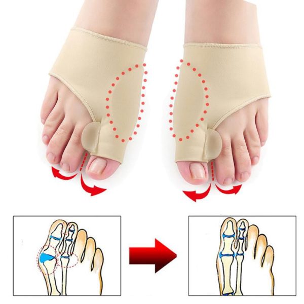 Ergonomic Pain Relief Toe Straightener Foot Bunion Corrector Orthopedic Hallux Valgus Relief Splint Gel Bunion Pads Sleeves Brace for Toe Spacer Online now - Image 2